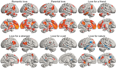 El cerebro en el amor